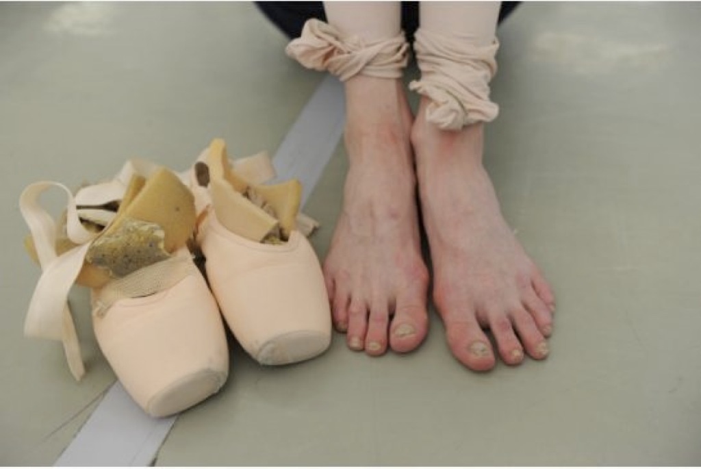 Featured image of post Fotos Pies Bailarinas Ballet Foto online classes les grands ballets canadiens de montr al